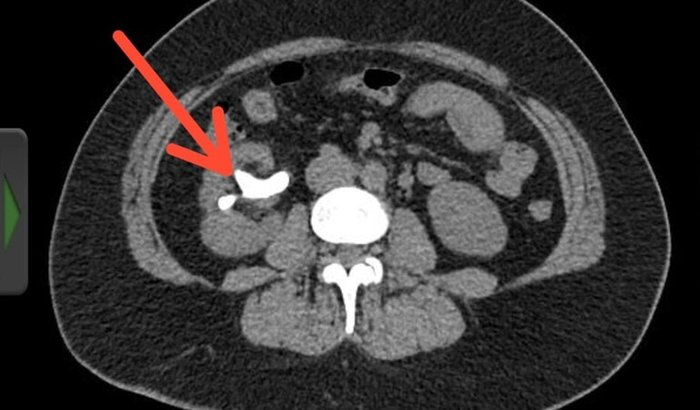 Cirurgia URGENTE - Tatiane Melo
