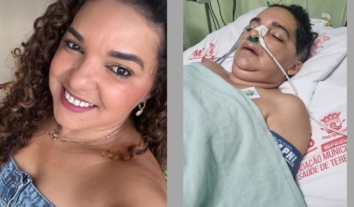 Ajude Betânia a continuar lutando pela vida 🙏🏽