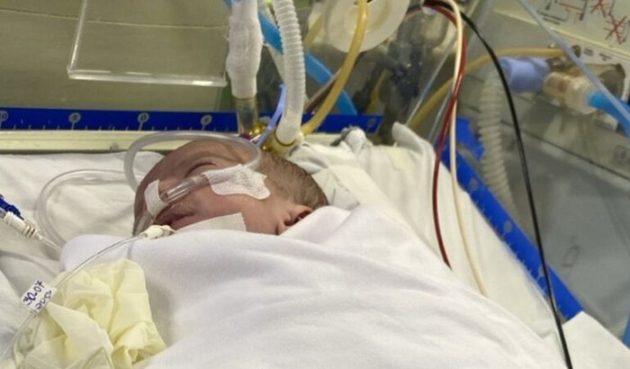 Ajuda na cirurgia do coração da Ana