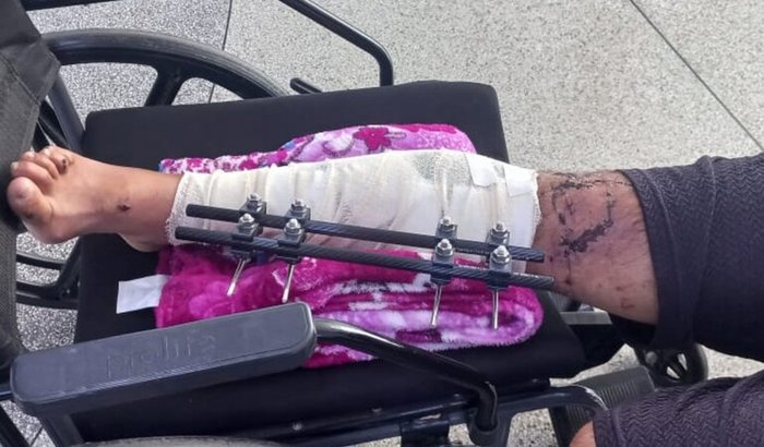 Ajudar com medicamentos e necessidades básicas