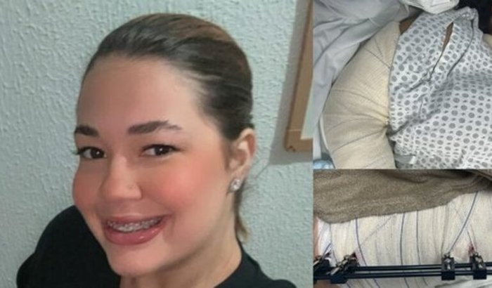 Ajude a Alana se recuperar