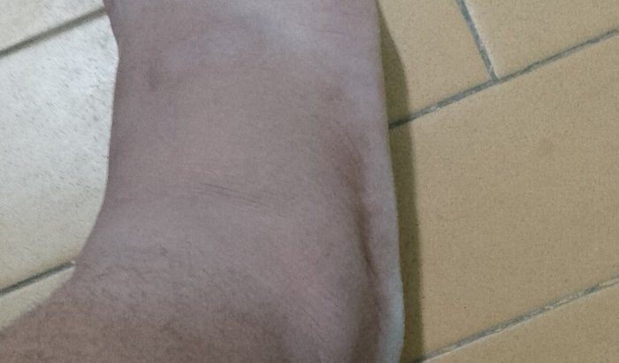 Ajuda na minha alimentação para mim sobre vive