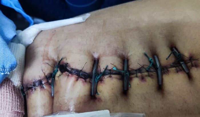 Compras de medicamentos