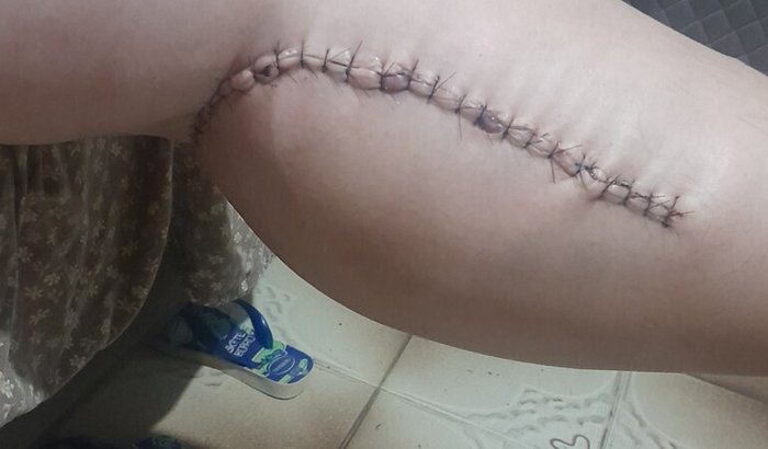 Ajude a Susan e família