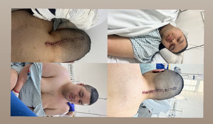 Ajude no Pós Operatório do Andreas