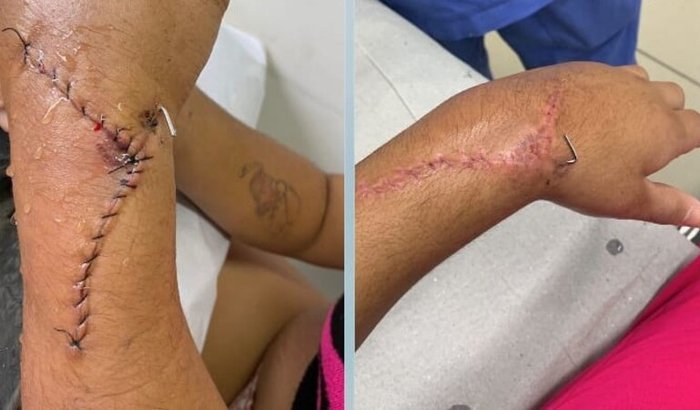 Ajude a Geovana a recuperar os movimentos da mão!