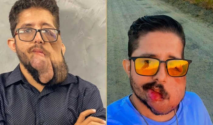 Ajuda com despesa como Hospedagem, alimentação e outros