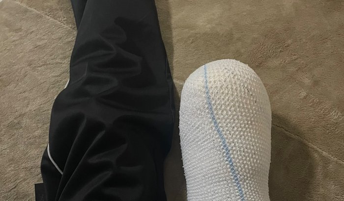 Me Ajude a comprar uma Prótese para perna