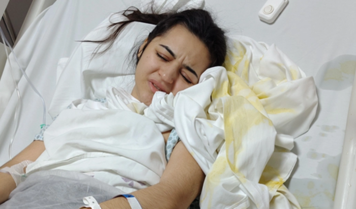 Tratamento Da Milly Mariano