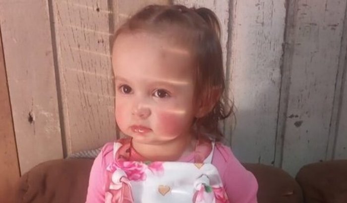 Cirurgia de dreno nós ouvidos da Agatha