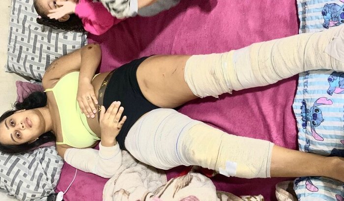 Ajuda após acidente de moto-trabalho parado