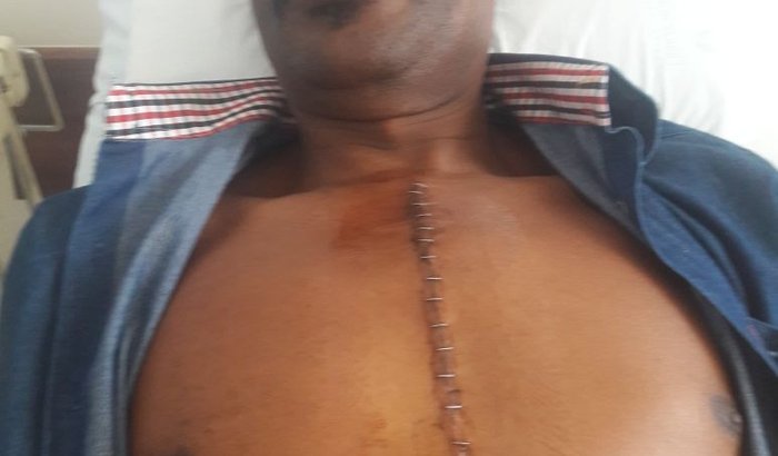 Cirurgia Cardiovascular e tumor no coração.