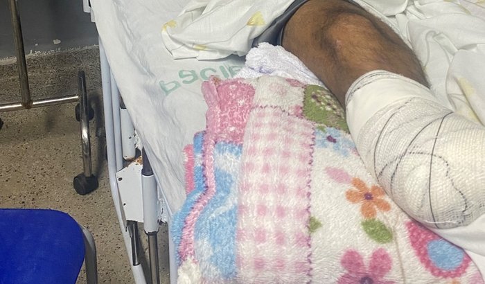 Reabilitação de Gilmar Paulino