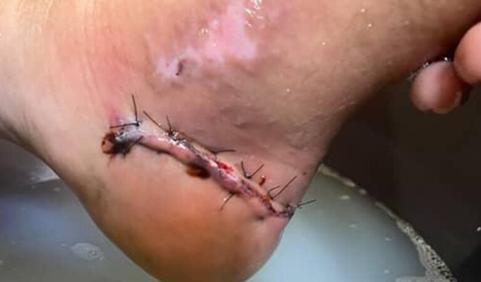 Ajuda para os remédios e ortopedia pra Bia