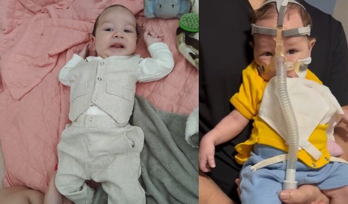 Ajude o pequeno Liam na sua luta contra a AME Tipo 1