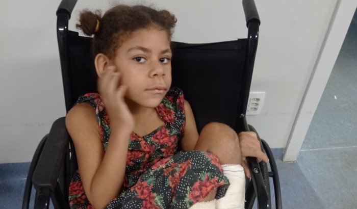 Bota ortopédica para Alice