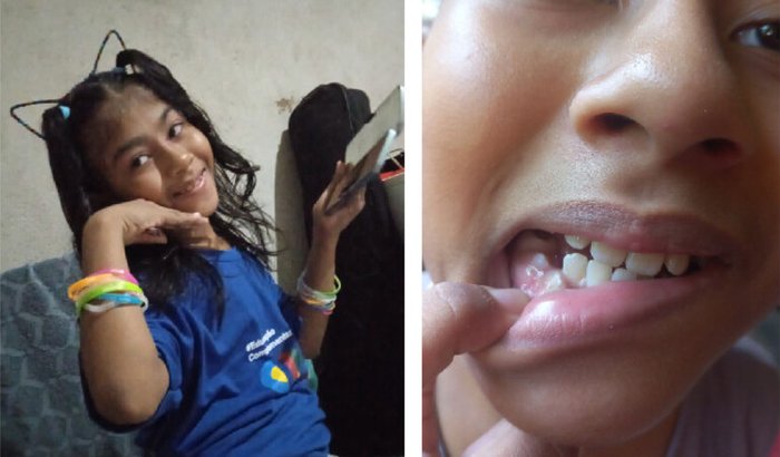 Ajude no tratamento dentário de Mônica