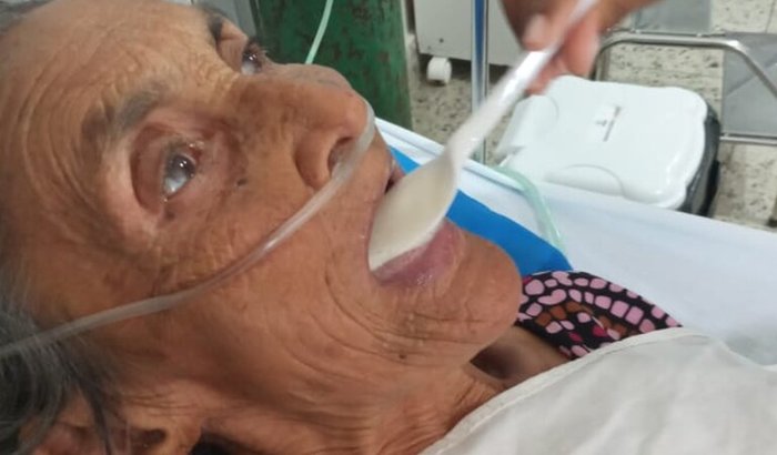 Ajuda na cirurgia ortoplastia parcial de Selvina