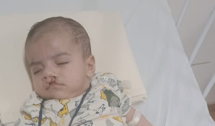 AJUDA PARA COMPRAR LEITE PARA BEBÊ COM ALERGIA A PROTEÍNA DO LEITE