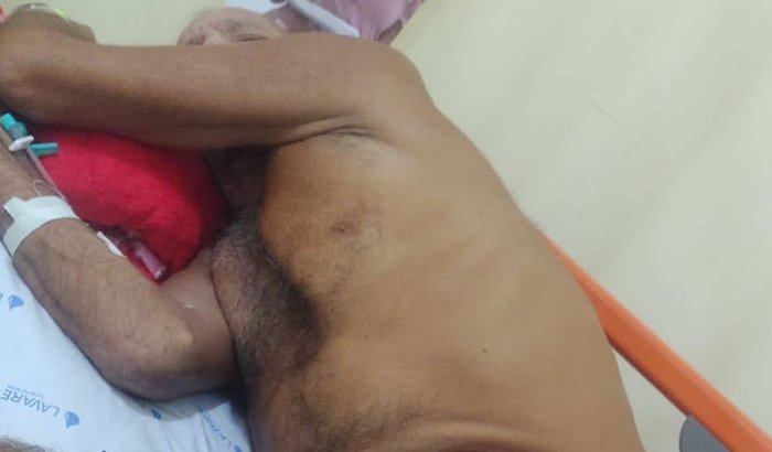 Ajuda para tratamento de câncer no estômago