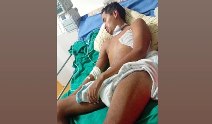 Recuperação do Audicélio