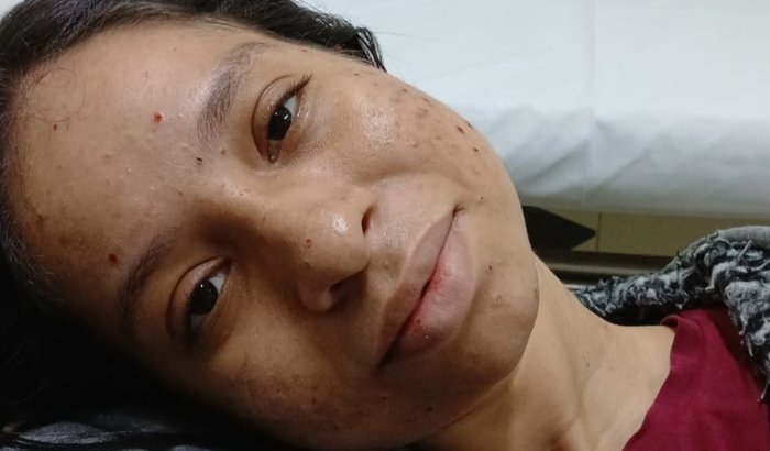 Tratamento Elizabeth - Porfiria Aguda