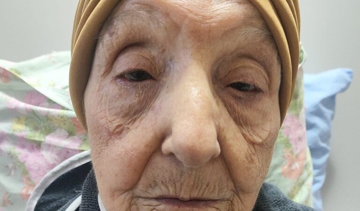 Bem estar da mamãe com Alzheimer avançado