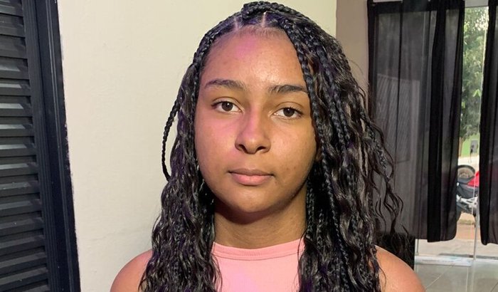 Cirurgia Ceratocone - Maria Eduarda