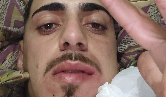 Tratamento Gu Caires