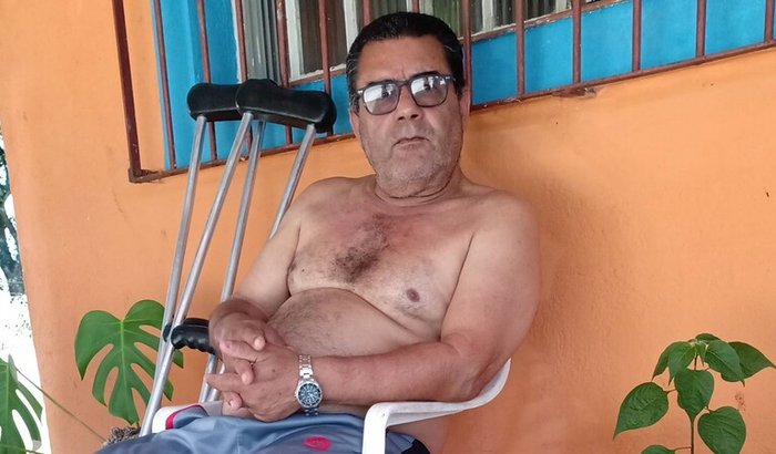 Precisa de uma prótese ortopédica pra perna