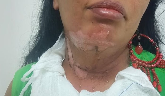 Juntos pela recuperação da Lore Tapuia