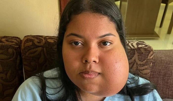 Vakinha beneficente para custear Prótese ATM e cirurgia