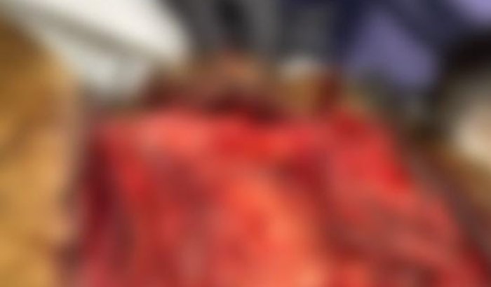 Ajuda Cachorra Atropelada na BR Ibirama