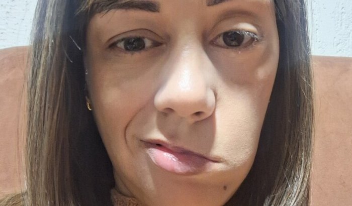 Reconstruindo meu sorriso