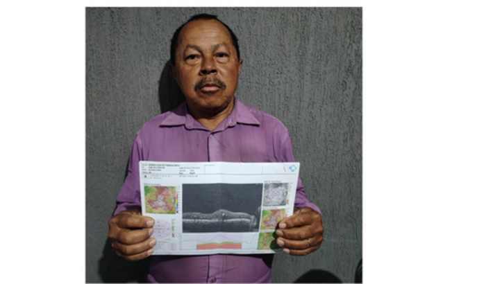 Preciso de ajuda pra não ficar cego