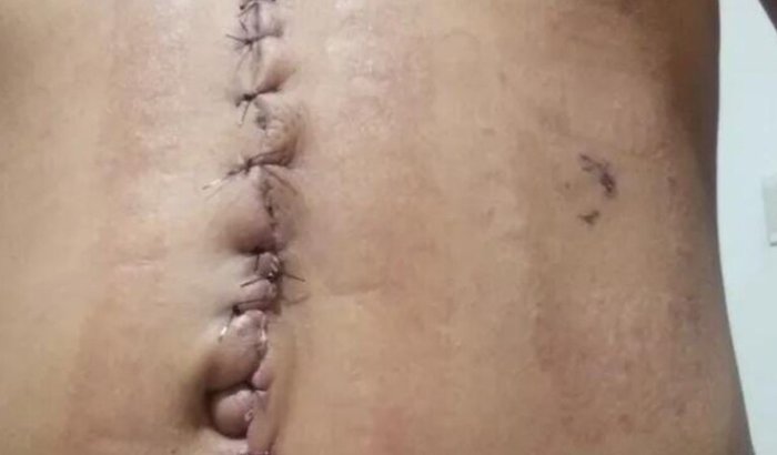 Ajuda para tratamento psicológico após tentativa de homicídio pelo próprio irmão