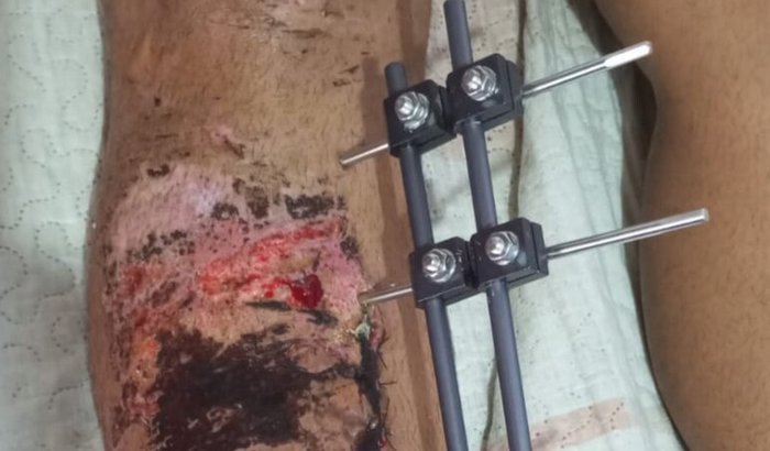 Ajuda pro meu tratamento