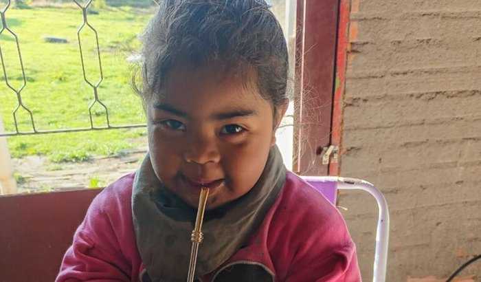 Cirurgia de adenoamigdalectomia da Yasmim