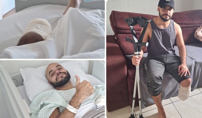 Doação do bem para compra de Prótese