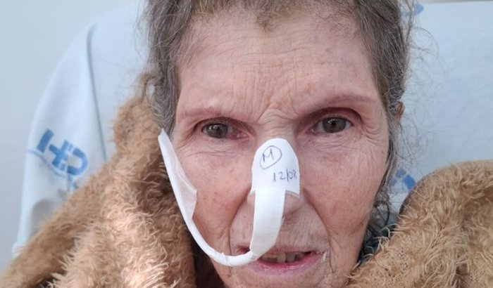 Internação por demência vascular