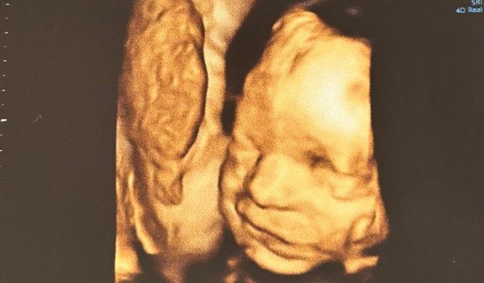 O futuro do Pedro começa com seu coração