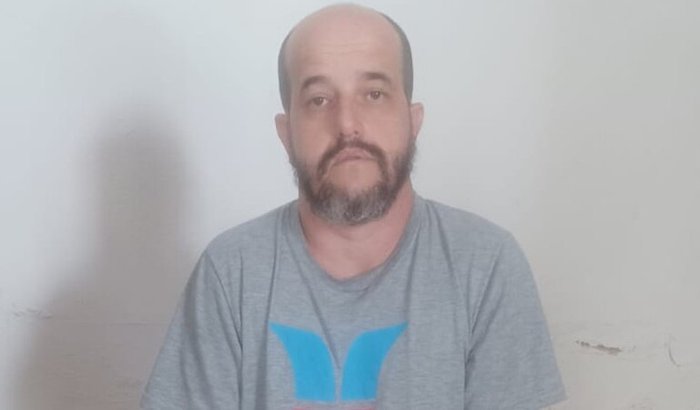 Cirurgia na Coluna-Escoliose