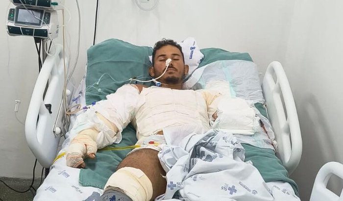 🙏 Ajude Washington a se reerguer após grave acidente de trabalho