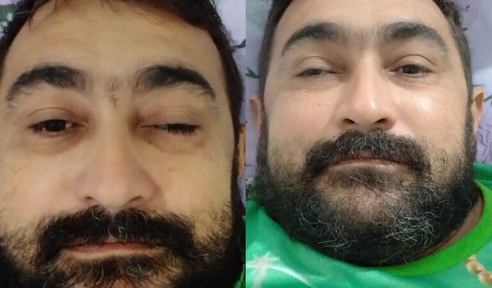 URGENTE: apoio à cirurgia do Nonato contra tumor cerebral