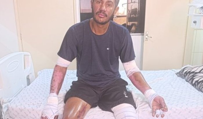 Ajuda para custear minha recuperação!