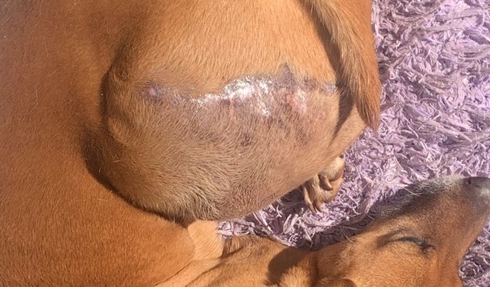 Amputação retirada de tumor maligno