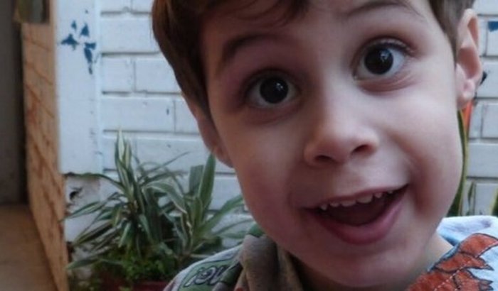 Cirurgia do Pequeno Théo