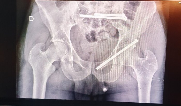 Fisioterapia Marcelo Dimare Campello