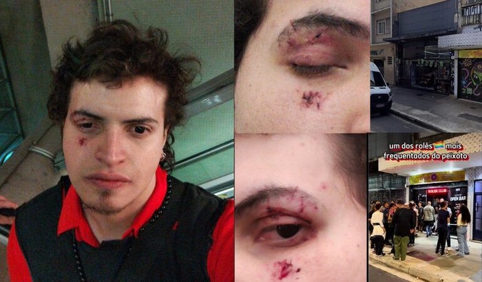 Agressão na boiler club - Reparos aos danos