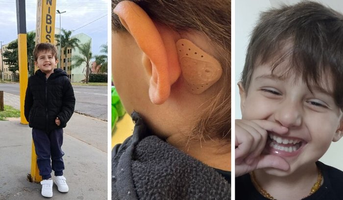 Ajude o Theodoro voltar a ouvir!